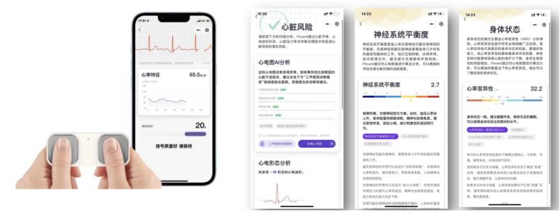 基于自研心电芯片国产化手持单导/6导/12导心电仪解决方案-供求信息论坛-供求信息-新通供应链论坛